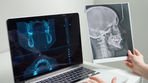 x-rays on a laptop screen in an x-ray room. doctor dentist radiologist examines radiographic shots of the jaw and teeth of the patient.