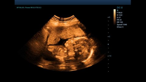 A small child in the mother's stomach. The result of ultrasound of a pregnant girl. Ultrasound of the child in the mother's stomach. Ultrasound of a pregnant woman's abdomen.