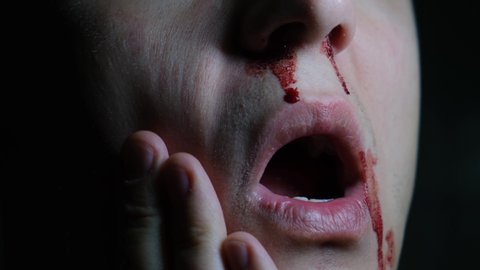 A man with nosebleed on his face is in pain, close-up