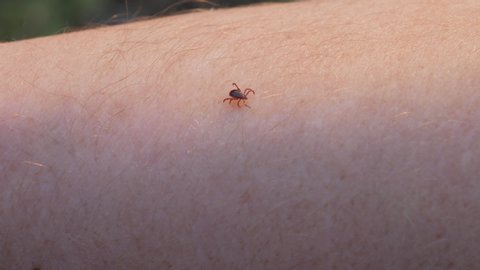Tick on the Skin Close Up. Ticks Carry Disease