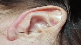 Closer look of the long needle on the ear of the lady that is a mature adult.Vertical Screen Orientation Video 9:16