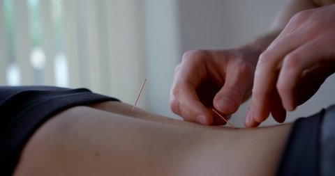 close-up of the osteopathy office. the acupuncture master removes the healing needles from the patient back