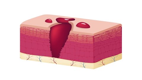 wound skin vector graphic . blood come out of wound graphic animation