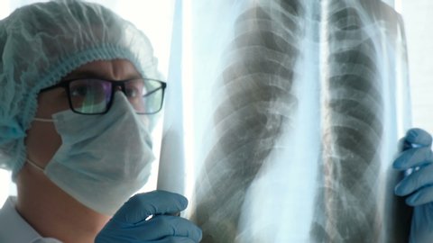 Close-up of a doctor examining a patient’s lung x-ray, closeup