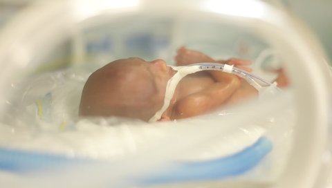 Premature Newborn Baby in the Tub