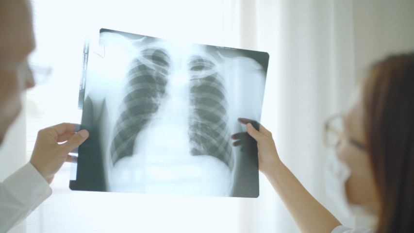 Mature Male doctor and young female colleague examining patient chest x-ray film lungs scan at radiology department in hospital. Covid-19 xray test, covid worldwide virus epidemic slow motion concept. Royalty-Free Stock Footage #1054218824