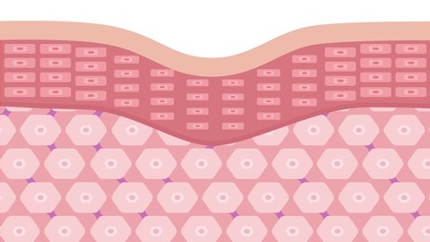 collagen in younger skin and aging skin , 3 type collagen skin version graphic animation