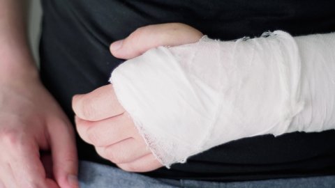 Rehabilitation after a broken arm. A man massages his hand in gypsum, close-up