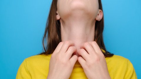 Close up of unhealthy young woman with allergy symptoms scratching neck, isolated on blue studio background, dressed yellow sweater. Health problem and skin diseases concept