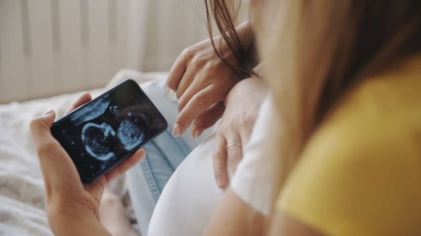 Happiness of motherhood, two women looking at ultrasound image of future baby on smartphone. Homosexual pregnant lesbian couple. IVF maternity, LGBT Pride Month, relationship, childbirth, concept. | Shutterstock HD Video #1054726619