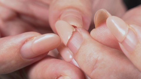 Closeup view video of broken nail of woman with old regrown worn manicure with abruption of gelpolish during period of staying home because of quarantine time.