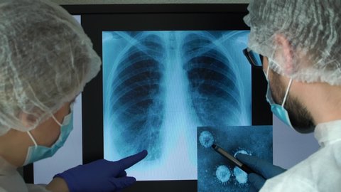 Team of scientists at computer monitor in laboratory analyzes lung x-ray with pneumonia and photo of virus of several times enlarged under microscope. Coronovirus