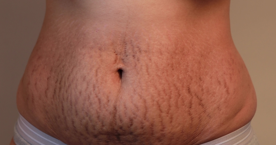 pregnancy close woman belly skin heavy: videoclip de stoc (100% royalty fre...