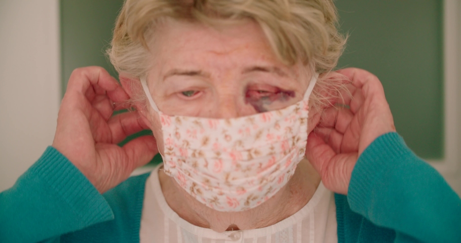 Elderly distressed female with black eye wearing face mask high risk concept Royalty-Free Stock Footage #1054935986