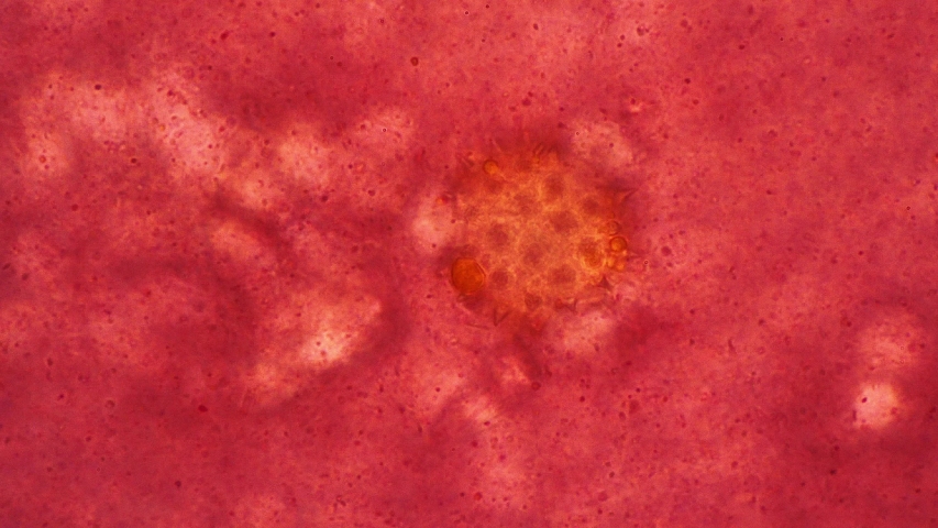 A pathogenic virus cell in the blood under a close-up microscope. Theme of viral diseases and detection of harmful cells. Concept of pathogens in microscopic world. Pollen of Tussilago plant shot.