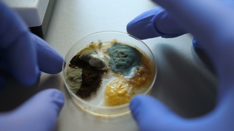 Scientist analyse in bacteria culture. Closeup. Petri dish with Bacteria in chemical lab. Hand in blue glove holds petri dish with mold and bacterium colony. Science professional grafting bacteria.