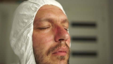 doctor during a coronavirus pandemic covid-19 takes off glasses and a protective mask, face marks are visible from the mask, red spots. Close portrait of a tired doctor