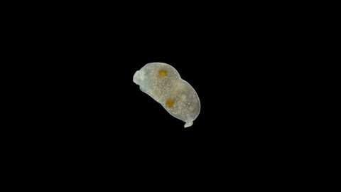 worm Microstomum sp. under the microscope, Microstomidae family, Macrostomida order, Turbellaria class, On the video you can observe defecatio how the worm gets rid of digested food, cleansing its