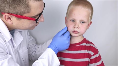 An allergist or dermatologist examines red spots on a child’s face. The boy suffers from a rash, hives and itching. Food Allergy, Insect Bite, Measles or Chicken Pox