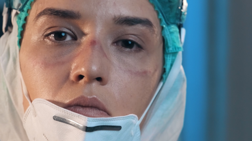 Female doctor during a coronavirus pandemic covid-19 takes off glasses and a protective mask after a shift in the hospital, and shows the wounds rubbed with protective mask, red spots. Tired nurse Royalty-Free Stock Footage #1055746760