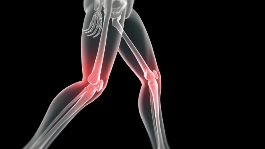 knee and joint pain animation Royalty-Free Stock Footage #1055780141