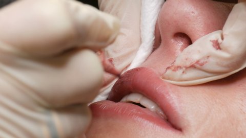 Microblading Lip Tattoo Special Coloring Pigment Stock Footage Video