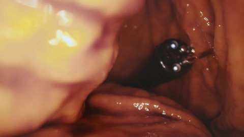 Endoscope inside the stomach. Water, mucus, and dust inside the stomach. Real image inside the stomach. Macro shot. 