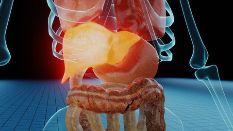 Damaged injured liver 3D render animation representation. Hepatitis cirrhosis cancer or other health problems. Medical inflammation of internal organs. Hepatic failure disease