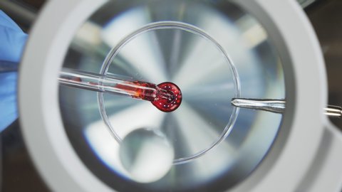 Drop of blood under the microscope, vaccine research. A scientist conducts a blood test for a virus. Close-up view from above
