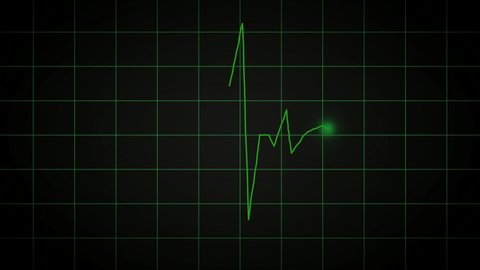 Heart rate or heart beat line. Electrocardiogram signal beat process on display monitor in hospital. Loop glow green line wave frequency. Patient Pulse rhythim. 4k footage animation.