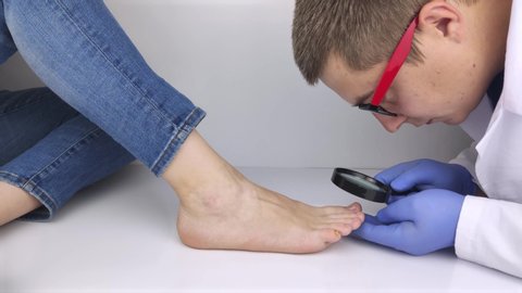 A trichologist examines a toenail with a magnifying glass, which is affected by the fungus. Treatment of mycosis and assistance to patients with fungal diseases.