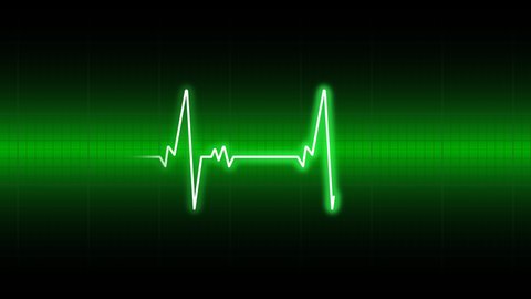 Heartbeat cardiogram. EKG or ECG with motion heart line. Green electrocardiogram. 4K video animation.