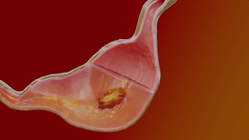 Human Stomach Anatomy Digestion, 3D reander | Shutterstock HD Video #1056414446