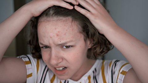 The girl carefully looks in the mirror at her face. She is very upset by teenage acne.