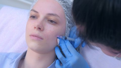 Cosmetologist doctor is making multiple injections biorevitalization with hyaluronic acid in woman face skin on cheek, closeup. Beautician on mesotherapy and face lifting procedure in beauty clinic.