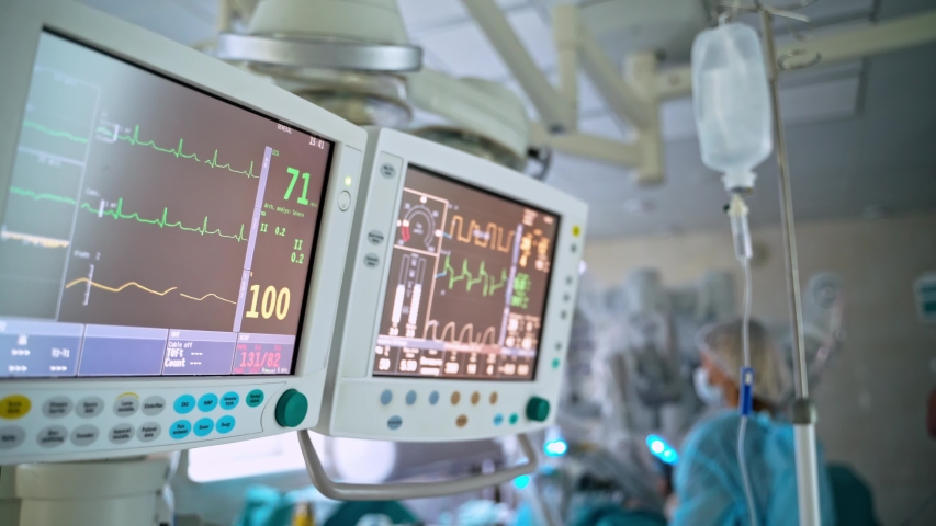 Monitors in intensive care unit. Heart beat of a patient on the screen of computers during operation in the hospital. Healthcare concept. Royalty-Free Stock Footage #1056608060