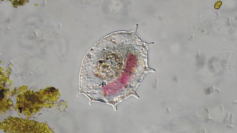 A realistic animation imitating a view through a microscope, with a microbe shriveling up and dying. As its membrane ruptures, its contents spill out.