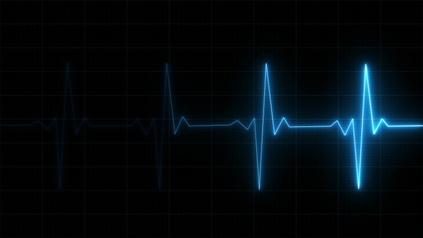Heart rate monitor electrocardiogram EKG or ECG looping background 02_4K Royalty-Free Stock Footage #1056894437