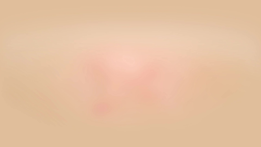 3D Animation skin acne repair Effect | Shutterstock HD Video #1057062878