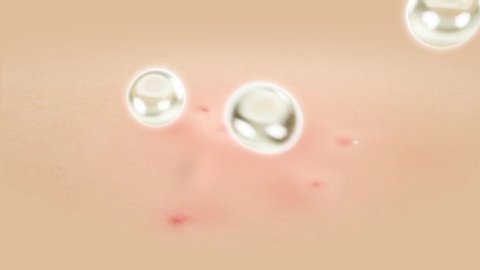 3D Animation skin acne repair Effect