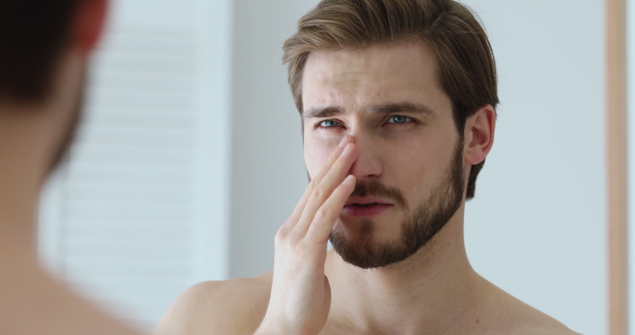 Close up head shot mirror reflection young man annoyed with dry unhealthy skin look, worrying about facial problems. Unhappy guy touching cheek, feeling stressed on oily skin or acne in bathroom. Royalty-Free Stock Footage #1057121894