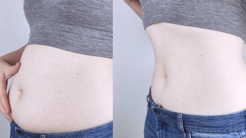 The girl shows the results of work on the body. Before and after a thick and thin waist. In the photo on the left, belly fat is visible. In the photo on the right, a thin waist without extra kilograms
