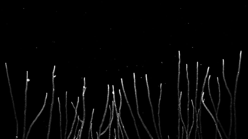 Timelapse of Aspergillus hyphae growing like a forest of slender trees. Aspergillus fumigatus stained with a fluorescent membrane dye and imaged using advanced confocal microscopy. Royalty-Free Stock Footage #1057237783
