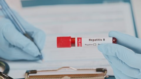 Doctor holds in one hand laboratory holds blood sample positive with hepatitis B virus label, other handwriting down results to patients medical record. Laboratory medical diagnostics