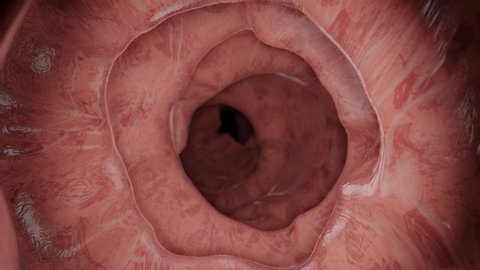 Animation of a Enteroscopy of the human intestines