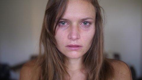 A close up, portrait shot of a young woman with wounds and bruises, looks and stares directly into the camera while a single tear is building up in her eye.