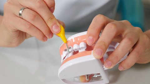 Orthodontic hygiene for braces. Female hands showing on artificial model of jaw mouth how to brush teeth with bracket system. Dentist cleaning jaw model with toothbrush, teaching dental care, 4 k