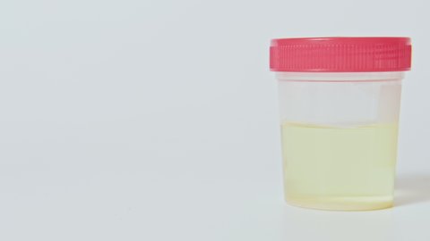 Urine test. Medical analysis. Yellow liquid sample in lab container with isolated on white copy space.