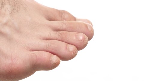 Closeup on the foot fingers of a young man. Human body part over a white screen background.