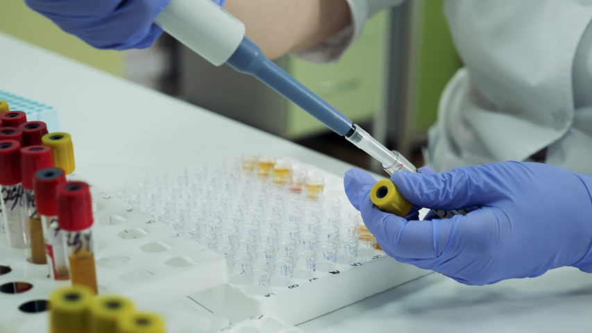Coronavirus, covid-19 laboratory test. Laboratory worker is filling glass tubes with plasma Royalty-Free Stock Footage #1057644232